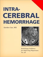 Intracerebral Hemorrhage by Gordon Sze, M.D.