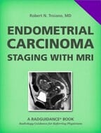 Endometrial Carcinoma: Staging with MRI by Robert N. Troiano, MD