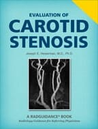 Evaluation of Carotid Stenosis by Joseph E. Heiserman, MD, PhD