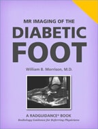 MRI of the Diabetic Foot by William B. Morrison, MD