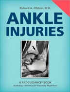Ankle Injuries by Richard A. Ofstein, MD