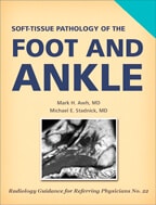 Soft Tissue Pathology of the Foot and Ankle by Mark H. Awh, MD