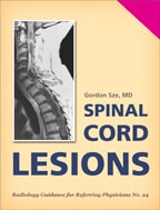 Spinal Cord Lesions by Gordon Sze, MD