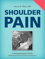 Shoulder Pain by Nancy M. Major, MD