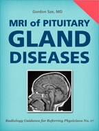 MRI of Pituitary Gland Diseases by Gordon Sze, M.D.