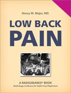 Low Back Pain by Nancy M. Major, MD