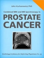 Combined MRI and MR Spectroscopy in Prostate Cancer by John Kurhanewicz, PhD