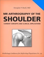 MR Arthrography of the Shoulder by Douglas P. Beall, MD