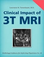 Clinical Impact of 3T MRI by Lawrence N. Tanenbaum, MD