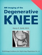 MR Imaging of the Degenerative Knee by Garry E. Gold, MD
