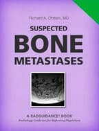 Suspected Bone Metastases by Richard A. Ofstein, MD